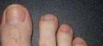 Mans_toenails.jpb